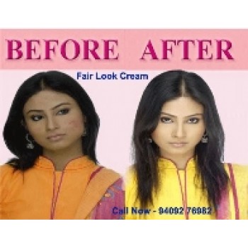 Fair Look Cream-Ayurvedic Preparation for Fair And Beautiful Skin, on 40% Off 